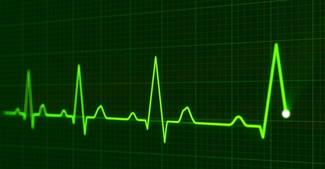 ICD 10 Impact on Cardiac Rhythm Management